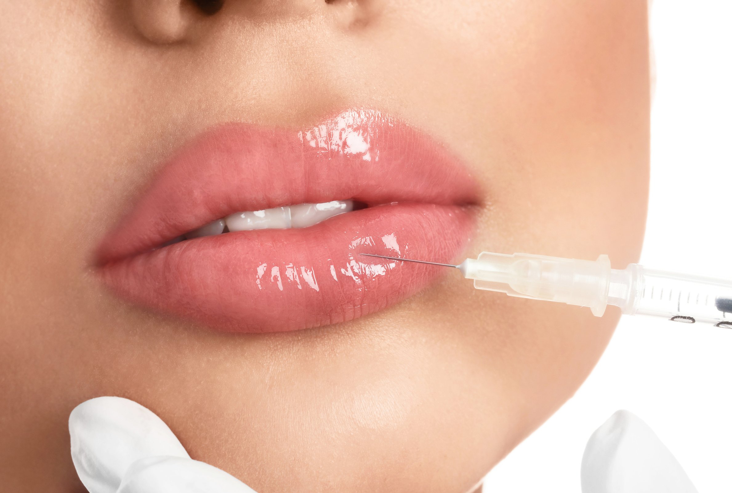 Young Woman Getting Lips Injection on White Background, Closeup
